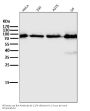 Anti-STAT5A/B Rabbit Monoclonal Antibody