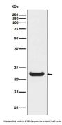 Anti-RBP4 Monoclonal Antibody