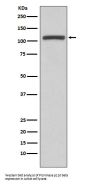 Anti-PI3 Kinase p110 beta PIK3CB Rabbit Monoclonal Antibody
