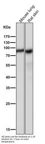 Anti-SCARB1/Sr Bi Rabbit Monoclonal Antibody