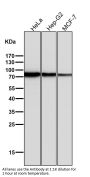 Anti-SCARB1/Sr Bi Rabbit Monoclonal Antibody
