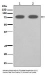 Anti-SCARB1/Sr Bi Rabbit Monoclonal Antibody