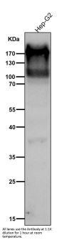 Anti-C4A Monoclonal Antibody