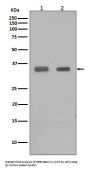 Anti-CEBP Beta Rabbit Monoclonal Antibody