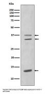 Anti-CEBP beta Rabbit Monoclonal Antibody