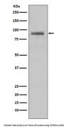Anti-Hsp90 alpha HSP90AA1 Rabbit Monoclonal Antibody