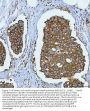 Anti-Hsp90 alpha + beta HSP90AA1 Rabbit Monoclonal Antibody