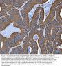 Anti-Hsp90 alpha + beta HSP90AA1 Rabbit Monoclonal Antibody