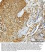 Anti-Hsp90 alpha + beta HSP90AA1 Rabbit Monoclonal Antibody