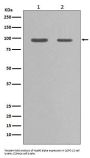 Anti-Hsp90 alpha HSP90AA1 Rabbit Monoclonal Antibody