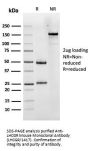 Anti-Luteinizing Hormone / Choriogonadotropin Receptor (LHCGR) Monoclonal Antibody