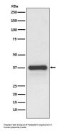Anti-Podoplanin PDPN Rabbit Monoclonal Antibody