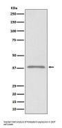 Anti-Podoplanin PDPN Rabbit Monoclonal Antibody