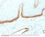 Anti-Podoplanin (PDPN) (Lymphatic Endothelial & Mesothelial Marker) Monoclonal Antibody