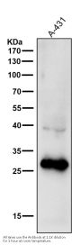 Anti-14-3-3 sigma SFN Rabbit Monoclonal Antibody