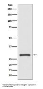 Anti-14-3-3 sigma SFN Rabbit Monoclonal Antibody