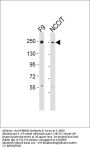 Anti-PBRM1 Antibody (C-term)