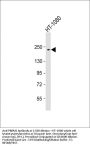 Anti-PBRM1 Antibody