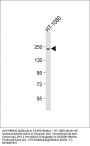 Anti-PBRM1 Antibody