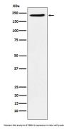 Anti-PBRM1 Rabbit Monoclonal Antibody
