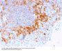 Anti-CD27 (Tumor Necrosis Factor Receptor Superfamily 7) Monoclonal Antibody