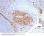 Anti-CD27 (Tumor Necrosis Factor Receptor Superfamily 7) Monoclonal Antibody