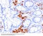 Anti-CD27 (Tumor Necrosis Factor Receptor Superfamily 7) Monoclonal Antibody
