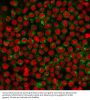 Anti-CD27 (Tumor Necrosis Factor Receptor Superfamily 7) Monoclonal Antibody