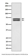 Anti-PDPK1/Pdk 1 Rabbit Monoclonal Antibody