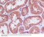 Anti-PDPK1/Pdk 1 Rabbit Monoclonal Antibody