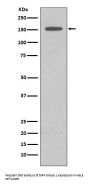 Anti-DAP Kinase 1 DAPK1 Rabbit Monoclonal Antibody