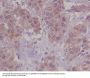 Anti-DAP Kinase 1 DAPK1 Rabbit Monoclonal Antibody