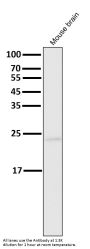 Anti-Bak BAK1 Rabbit Monoclonal Antibody