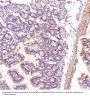 Anti-VDAC1/Porin Rabbit Monoclonal Antibody
