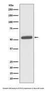 Anti-PKM2 Rabbit Monoclonal Antibody