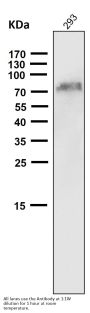 Anti-NGFR/P75 Rabbit Monoclonal Antibody