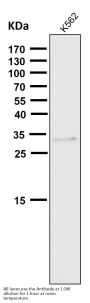 Anti-NGFR/P75 Rabbit Monoclonal Antibody