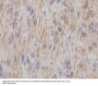 Anti-NGFR/P75 Rabbit Monoclonal Antibody