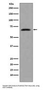 Anti-CDC7 Rabbit Monoclonal Antibody