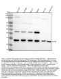 Anti-FGF19 Rabbit Monoclonal Antibody
