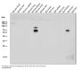 Anti-CHAT/Choline Acetyltransferase Rabbit Monoclonal Antibody