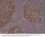 Anti-Stathmin (STMN1) Rabbit Monoclonal Antibody, Clone#RM350
