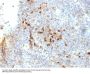 Anti-HLA-DRA (MHC II) Monoclonal Antibody