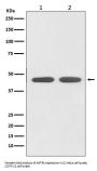 Anti-AGTR1 Rabbit Monoclonal Antibody
