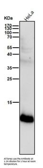Anti-S100A4 Rabbit Monoclonal Antibody