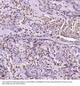 Anti-S100A4 Rabbit Monoclonal Antibody