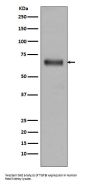 Anti-TGFBI/Beta Ig H3 Rabbit Monoclonal Antibody