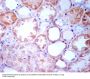 Anti-TGFBI/Beta Ig H3 Rabbit Monoclonal Antibody