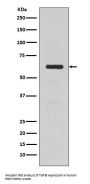 Anti-TGFBI/Beta Ig H3 Rabbit Monoclonal Antibody