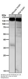 Anti-HAUSP / USP7 Rabbit Monoclonal Antibody